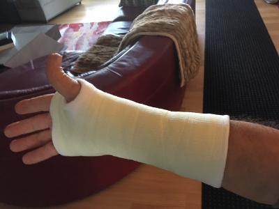 arm.jpg