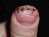thumb.JPG